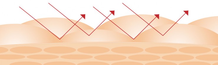 肌トラブルについて